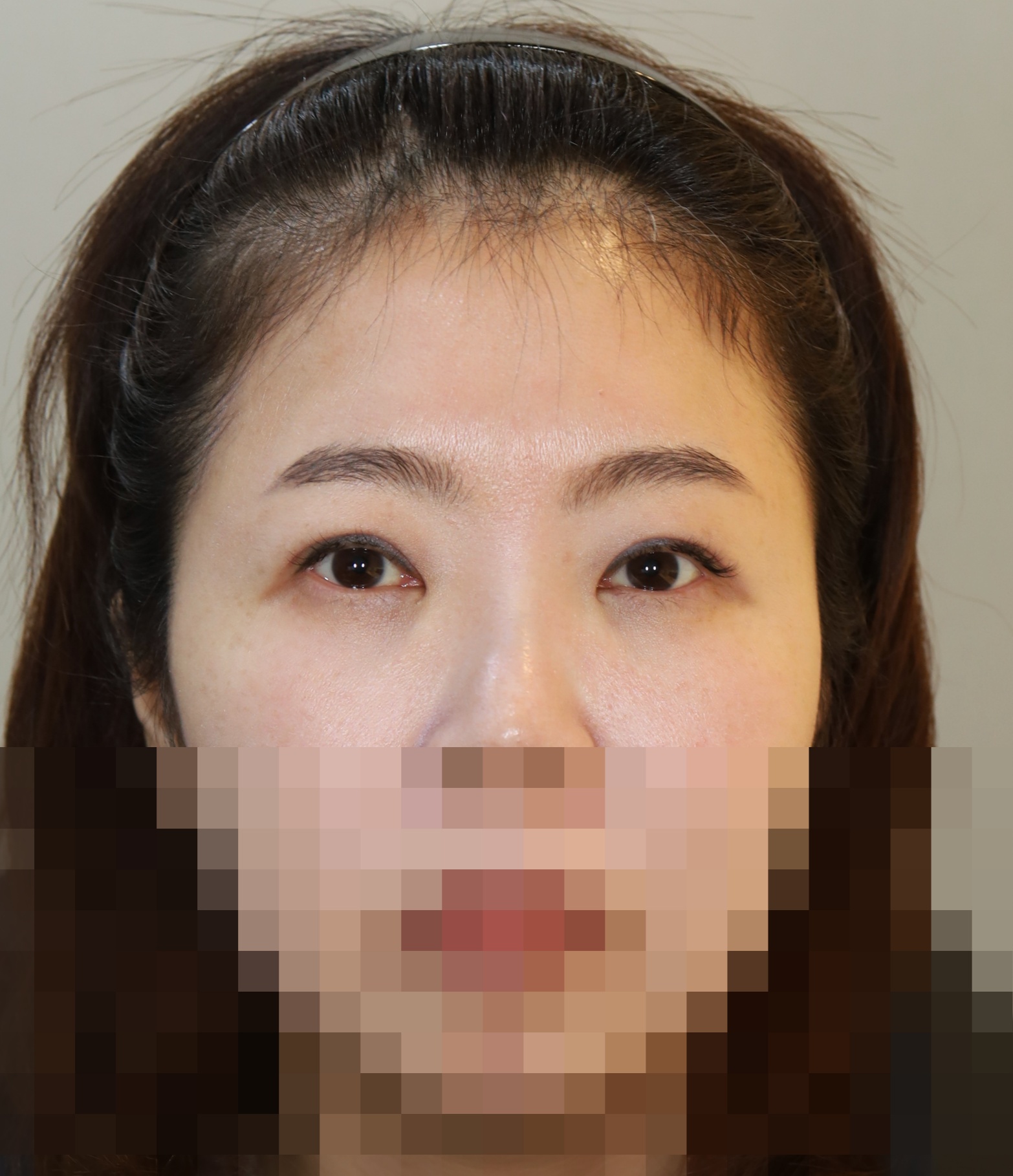 After