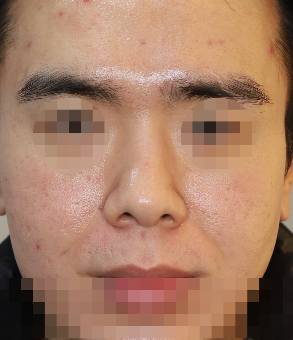 After