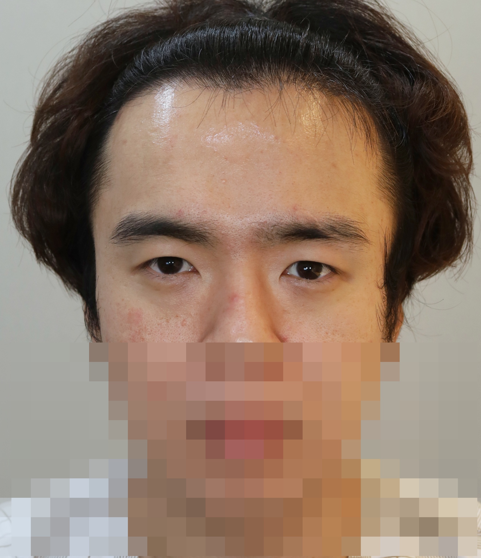 Before