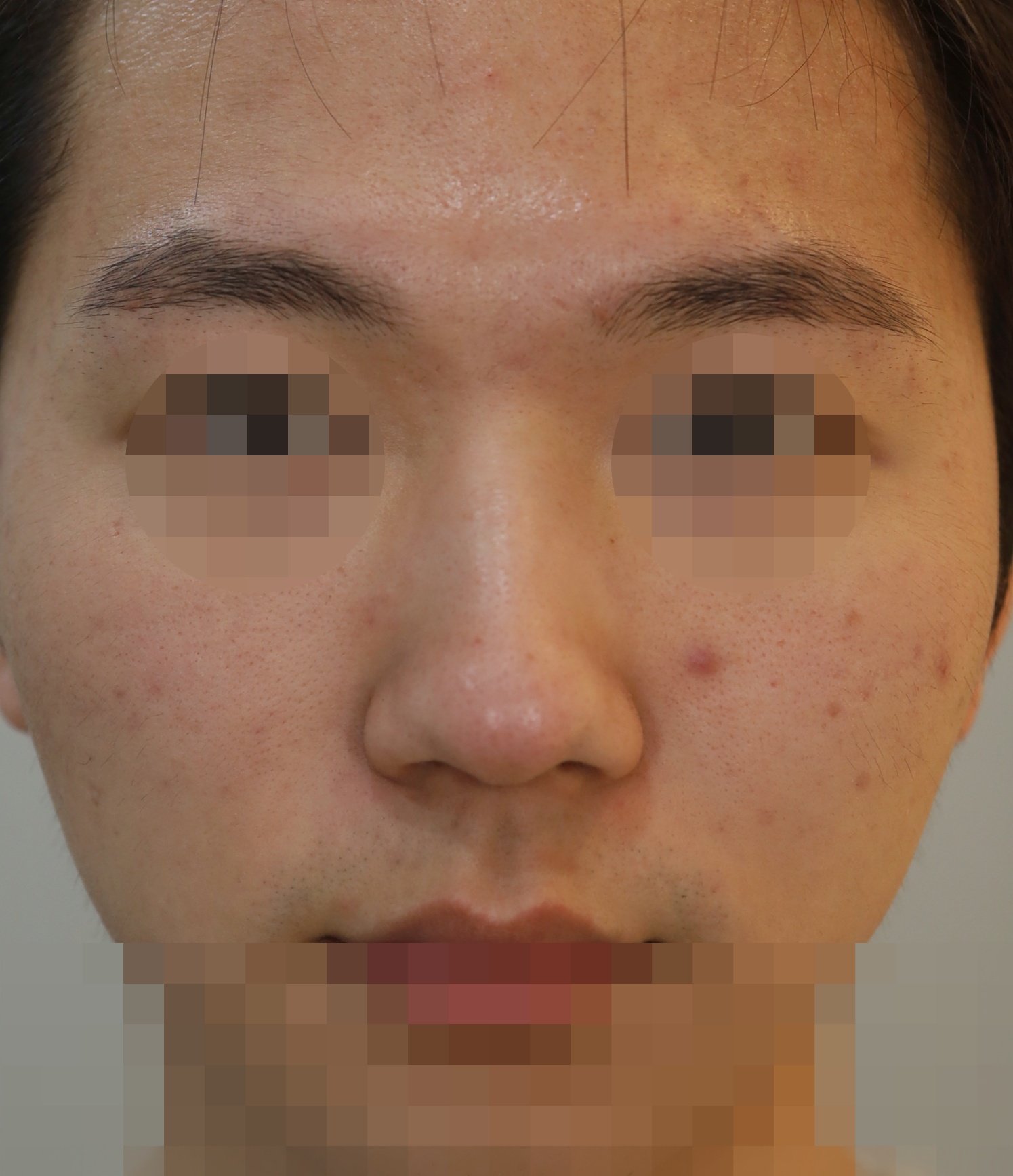 Before