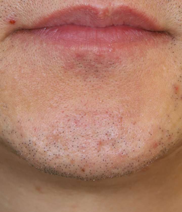 After