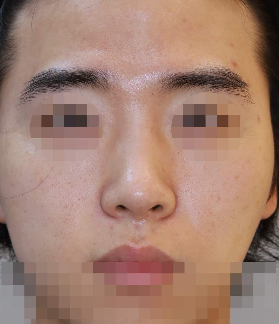 After
