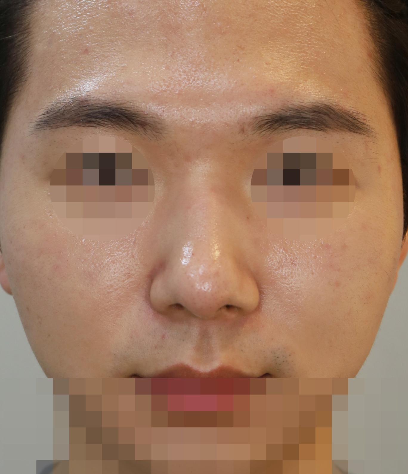 After