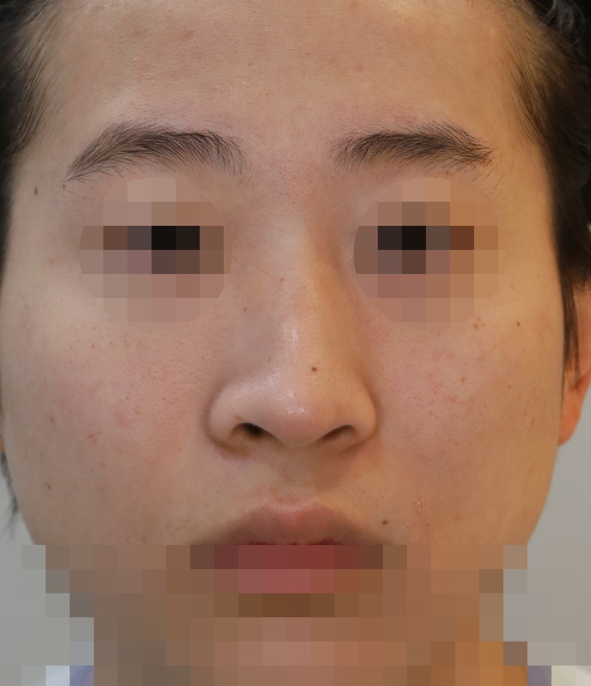 Before