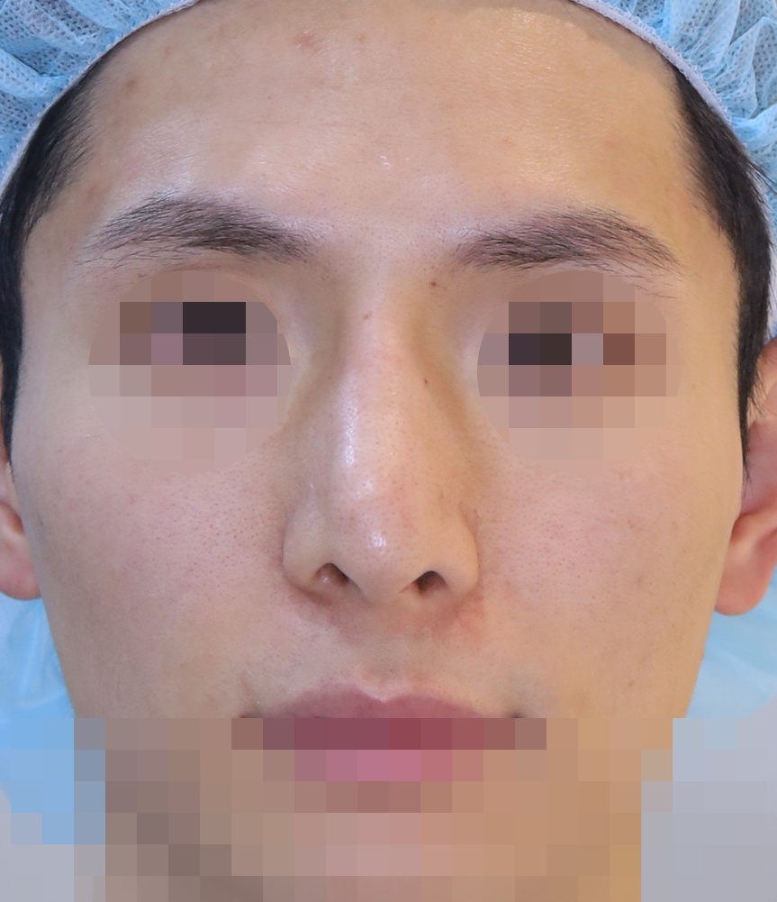 Before