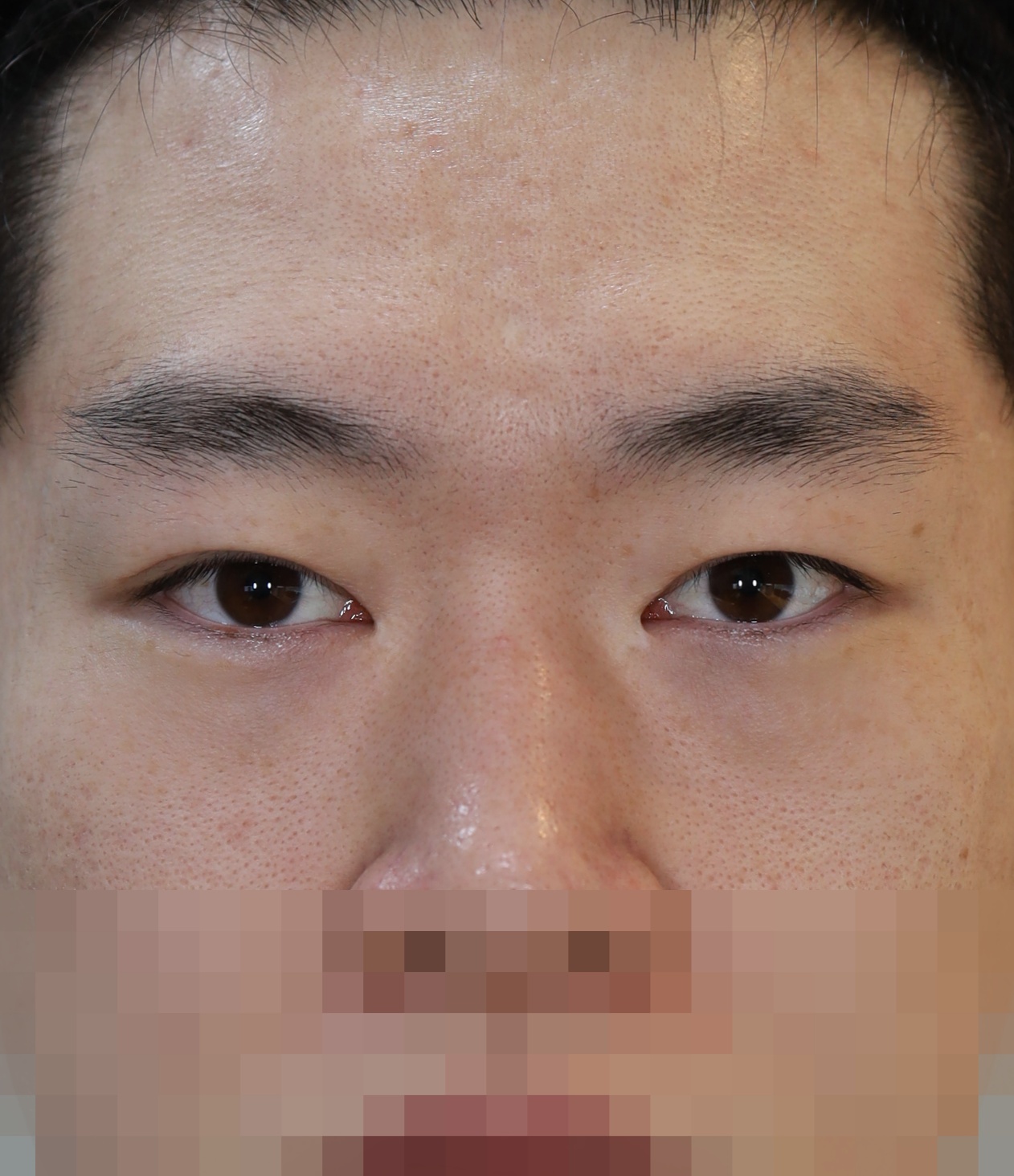 Before