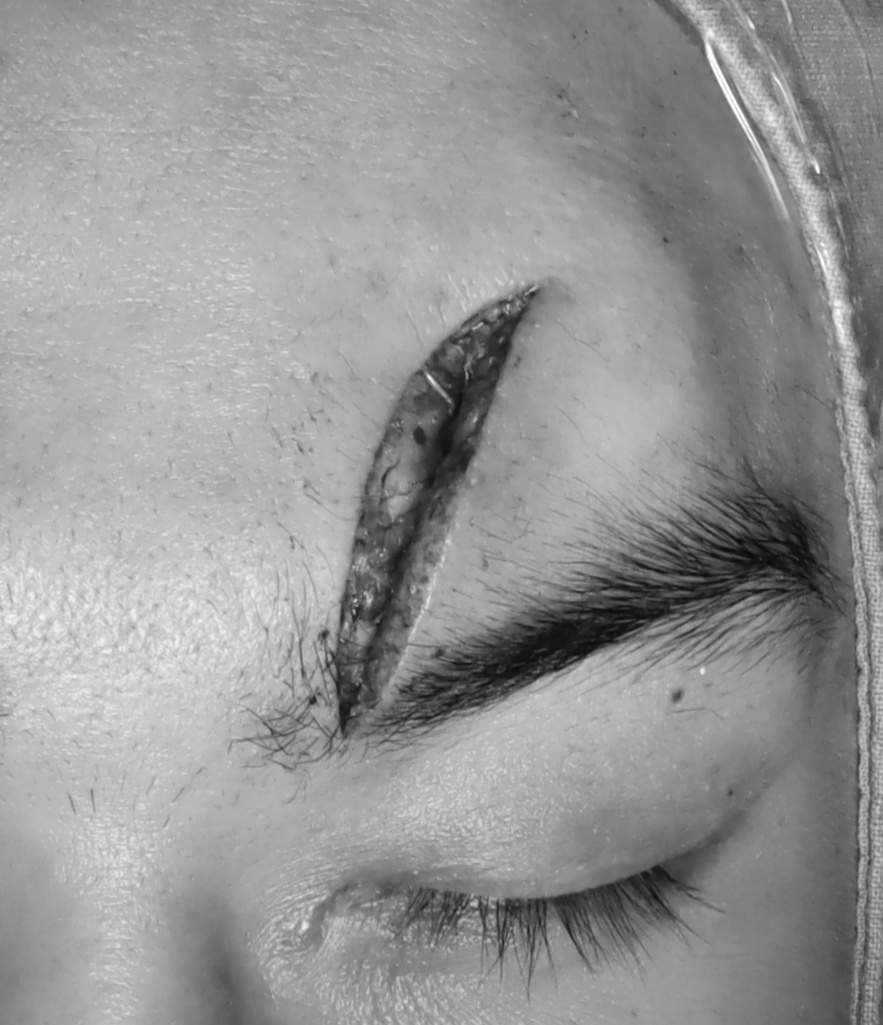 Before
