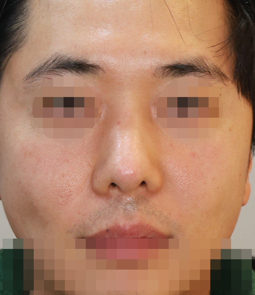 After