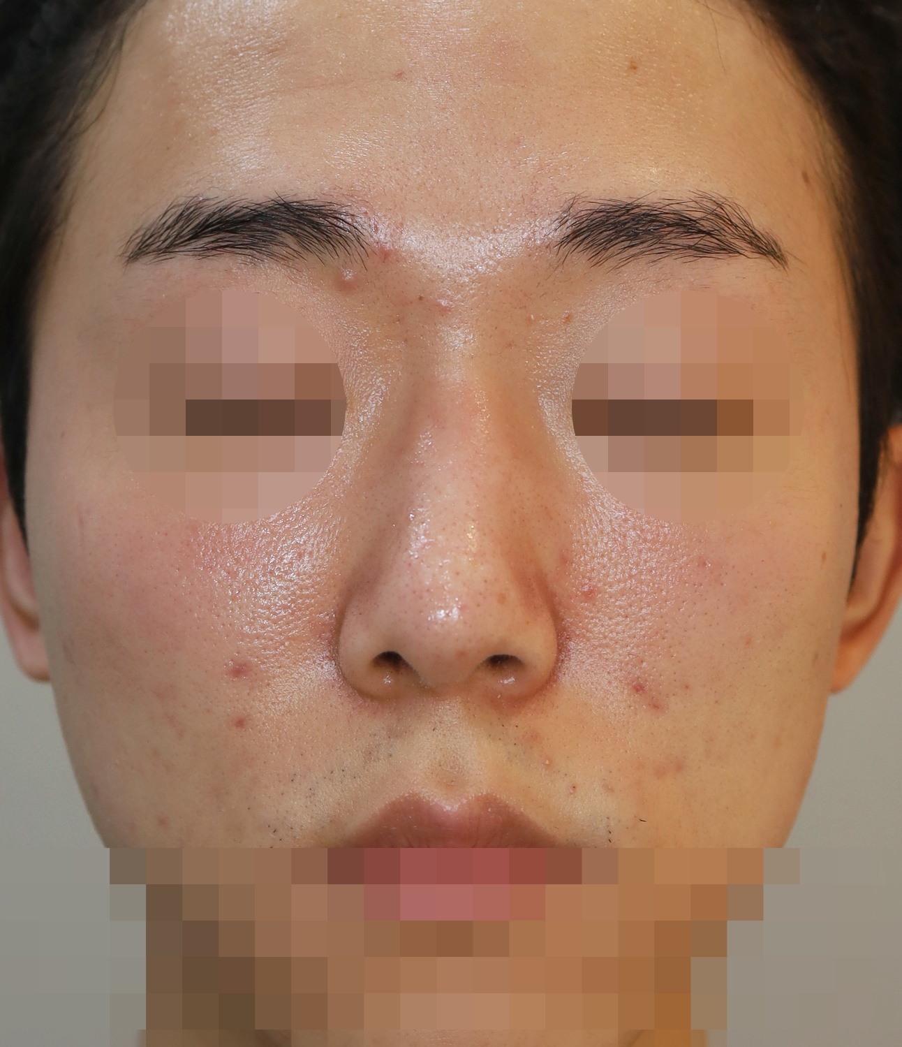 After