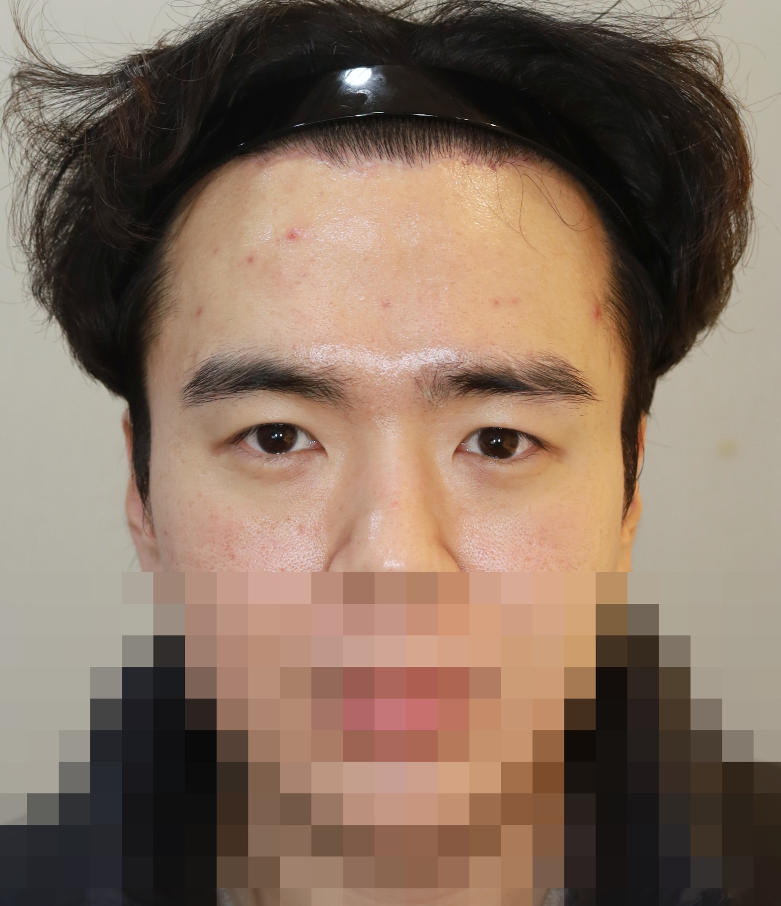 After
