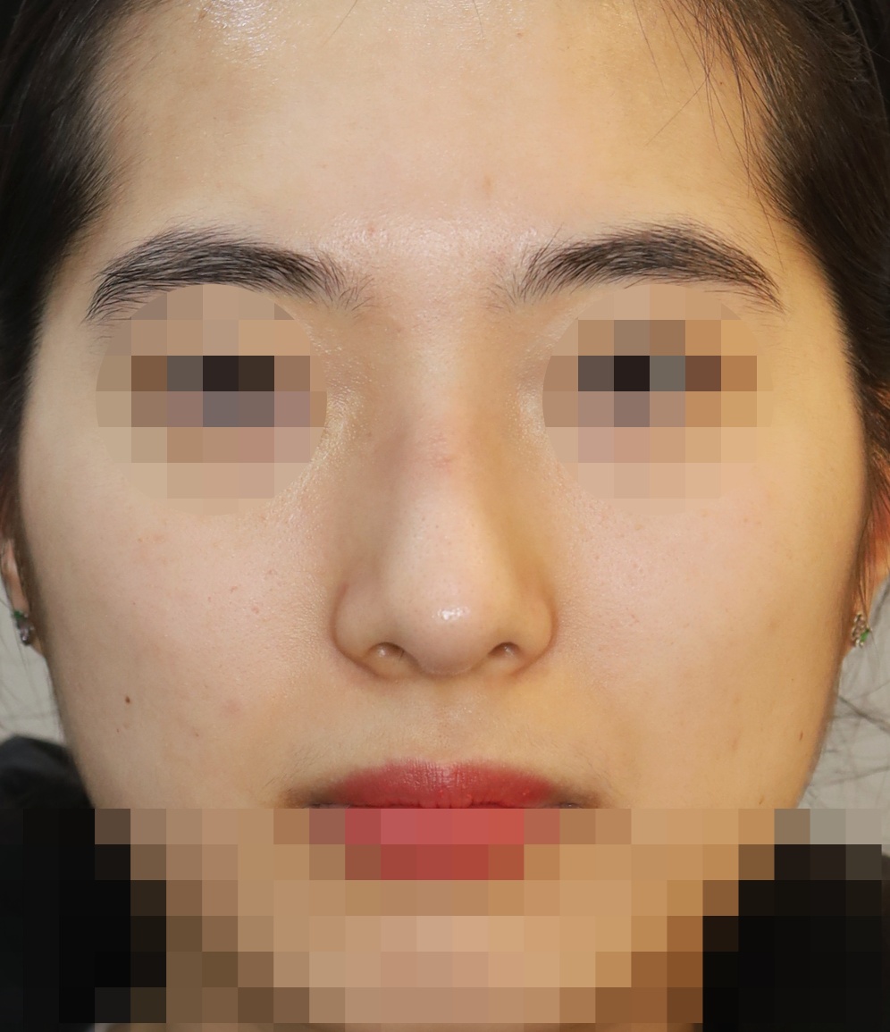 After
