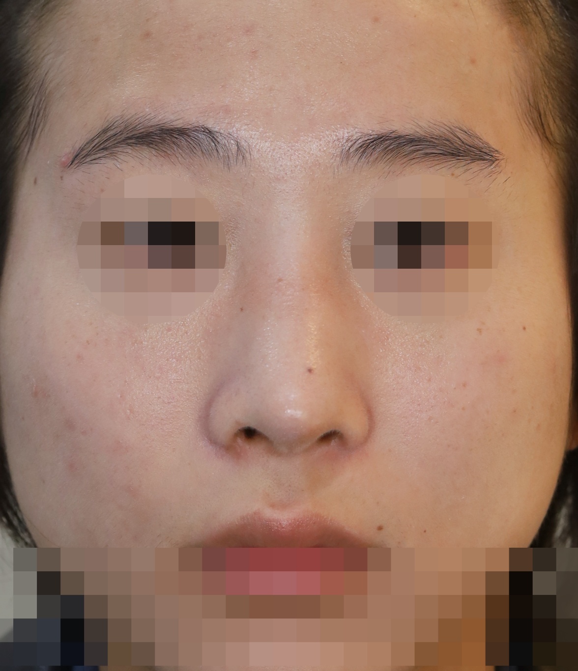 After