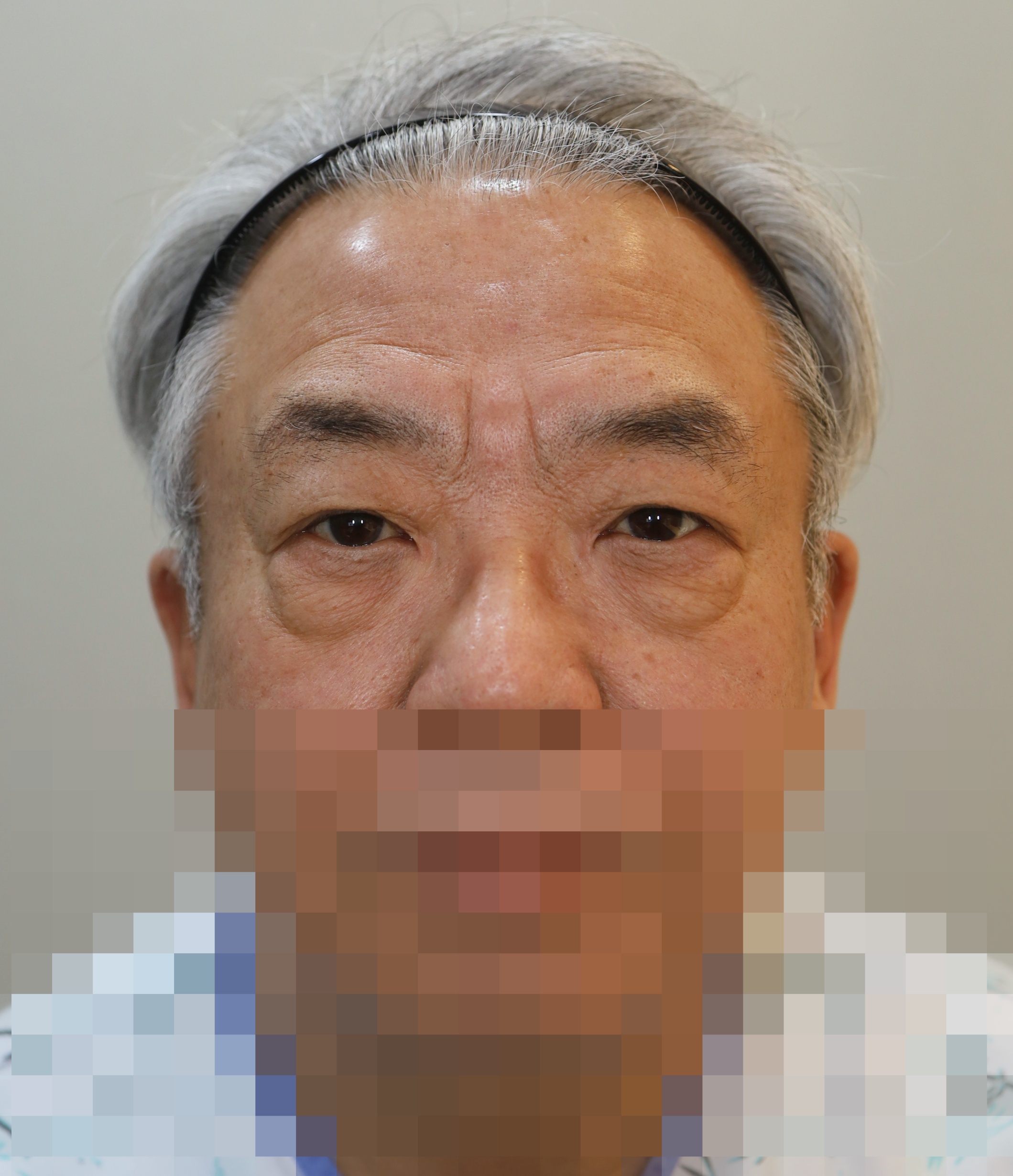 Before