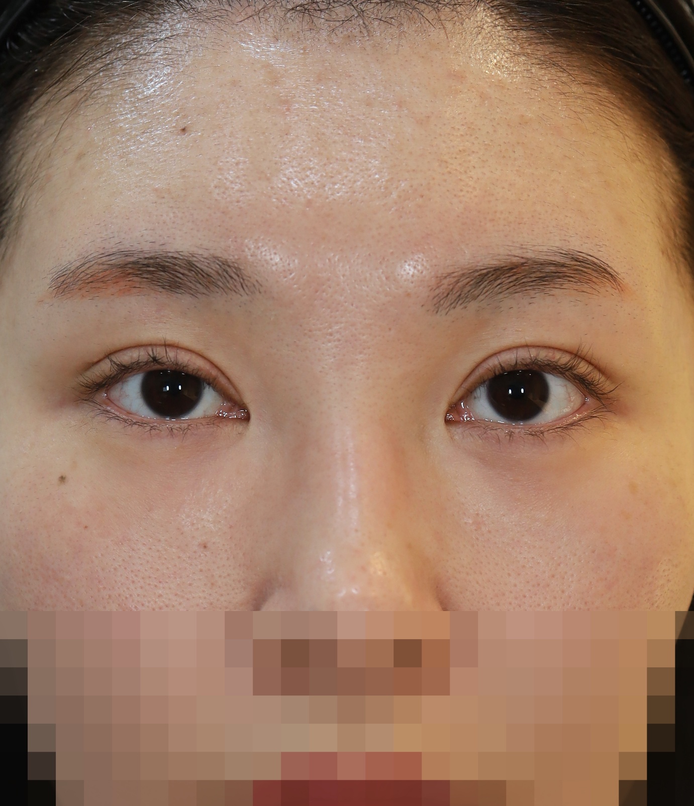Before