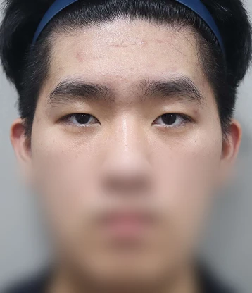 after 사진