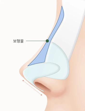 before 사진