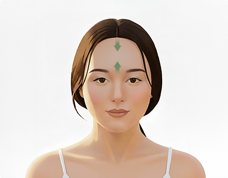 눈 밑 지방 재배치